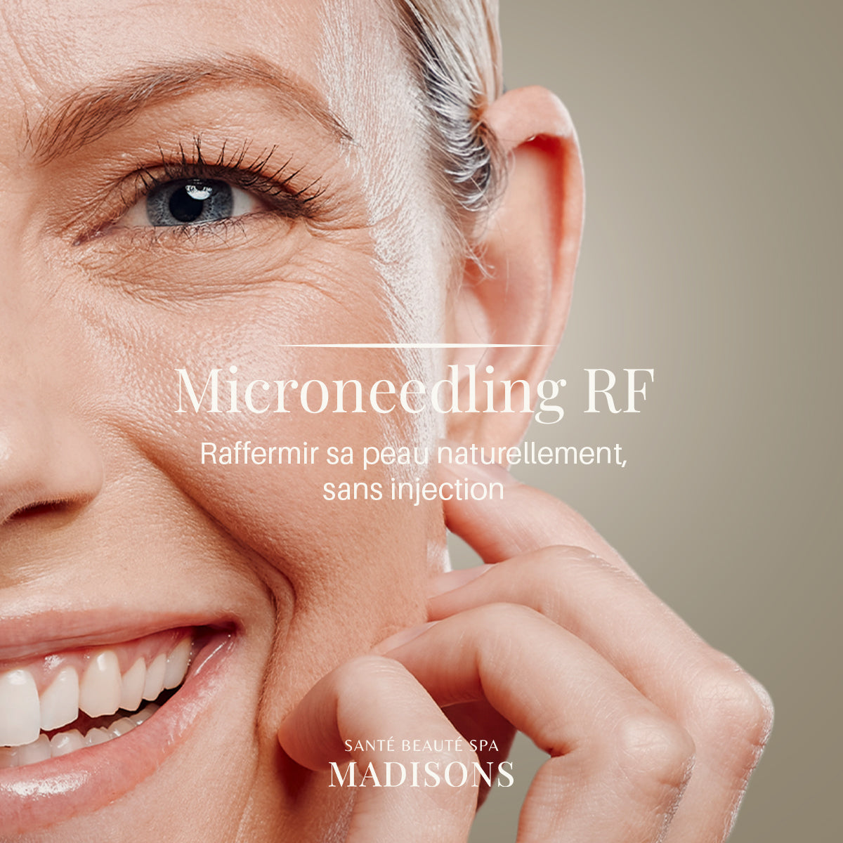 Microneedling RF vs Microneedling régulier : quelles différences et qui peut pratiquer ces soins ?